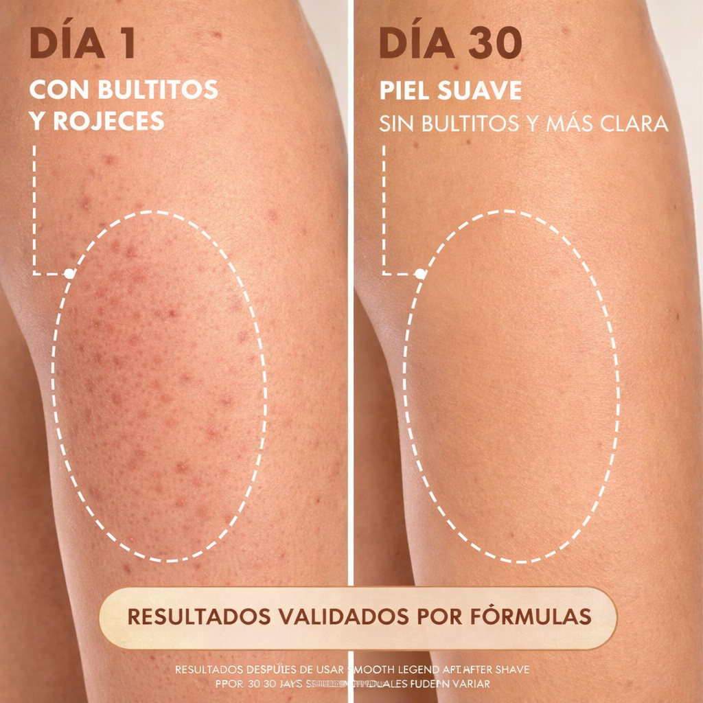 Aceite Truly para Después Depilación 90 ml