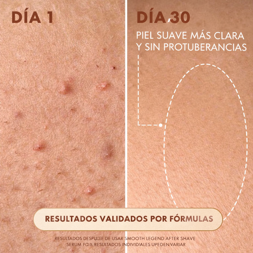 Aceite Truly para Después Depilación 90 ml