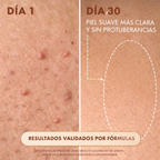 Aceite Truly para Después Depilación 90 ml